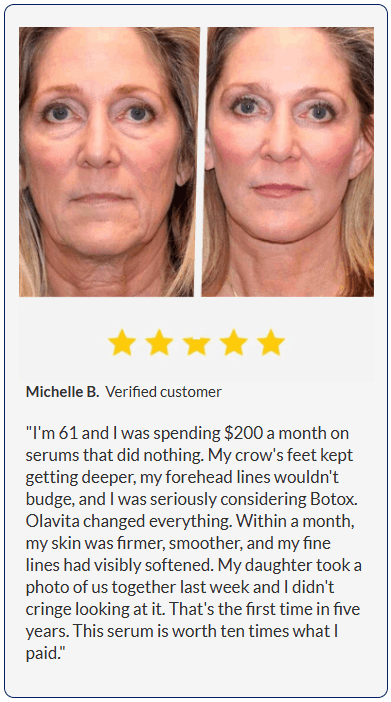 Luminara Rewind before and after comparison showing reduced wrinkles and improved skin firmness.